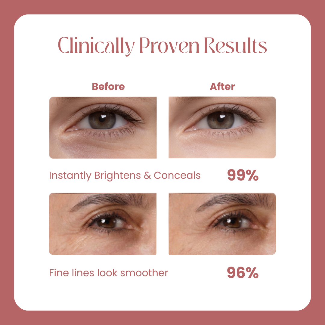 Cemenrete Calcium Dark Spot Eye Cream
