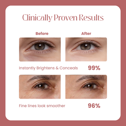 Cemenrete Calcium Dark Spot Eye Cream