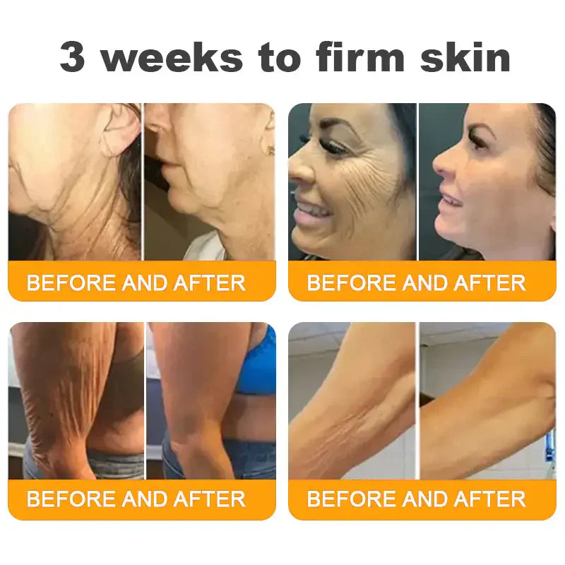Natravor™ 𝐁𝐞𝐞 𝐕𝐞𝐧𝐨𝐦 𝐀𝐥𝐥-𝐢𝐧-𝐎𝐧𝐞 𝐂𝐫𝐞𝐚𝐦–🌸 Anti-aging,Hydrating, Skin Repair, Even Tone, Acne and Dark Spot Treatment, Wart and Mole Removal, Psoriasis Relief