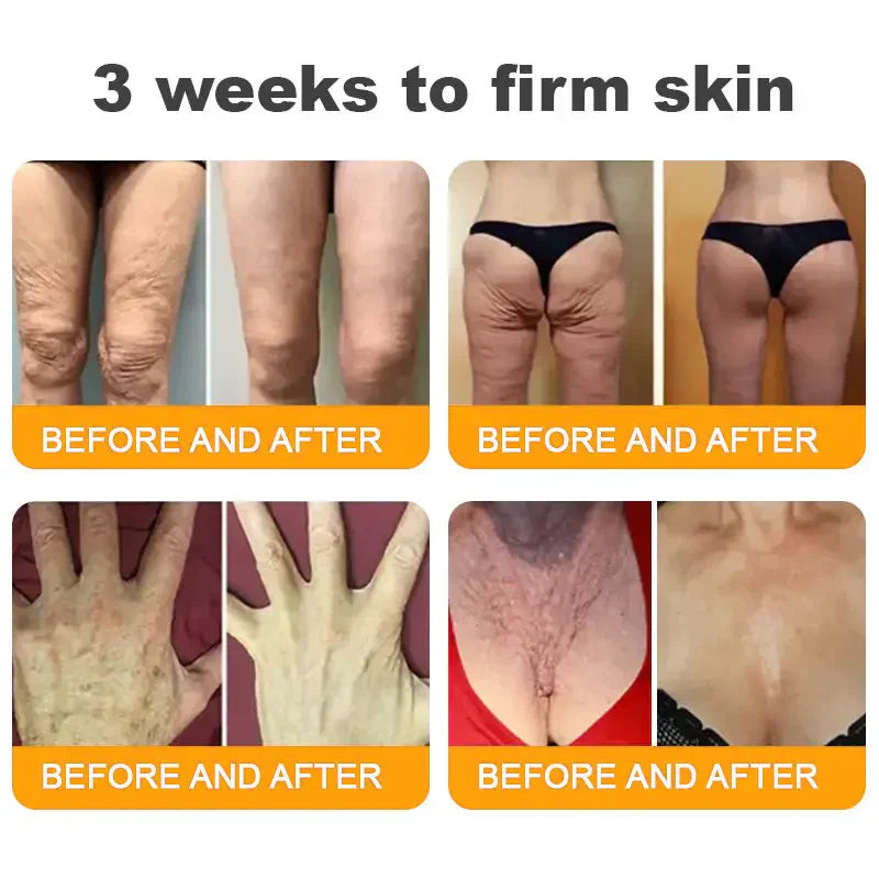 Natravor™ 𝐁𝐞𝐞 𝐕𝐞𝐧𝐨𝐦 𝐀𝐥𝐥-𝐢𝐧-𝐎𝐧𝐞 𝐂𝐫𝐞𝐚𝐦–🌸 Anti-aging,Hydrating, Skin Repair, Even Tone, Acne and Dark Spot Treatment, Wart and Mole Removal, Psoriasis Relief