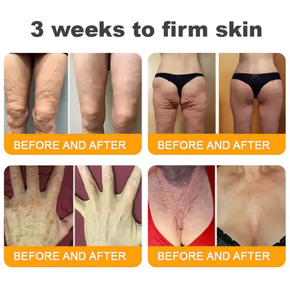 Natravor™ 𝐁𝐞𝐞 𝐕𝐞𝐧𝐨𝐦 𝐀𝐥𝐥-𝐢𝐧-𝐎𝐧𝐞 𝐂𝐫𝐞𝐚𝐦–🌸 Anti-aging,Hydrating, Skin Repair, Even Tone, Acne and Dark Spot Treatment, Wart and Mole Removal, Psoriasis Relief