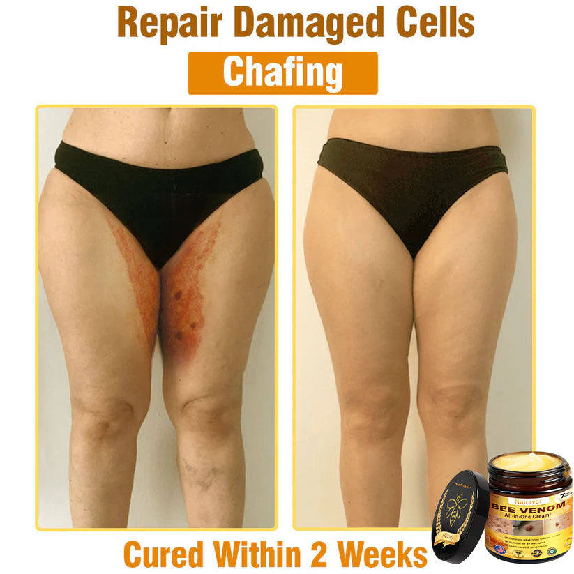 Natravor™ 𝐁𝐞𝐞 𝐕𝐞𝐧𝐨𝐦 𝐀𝐥𝐥-𝐢𝐧-𝐎𝐧𝐞 𝐂𝐫𝐞𝐚𝐦–🌸 Anti-aging,Hydrating, Skin Repair, Even Tone, Acne and Dark Spot Treatment, Wart and Mole Removal, Psoriasis Relief