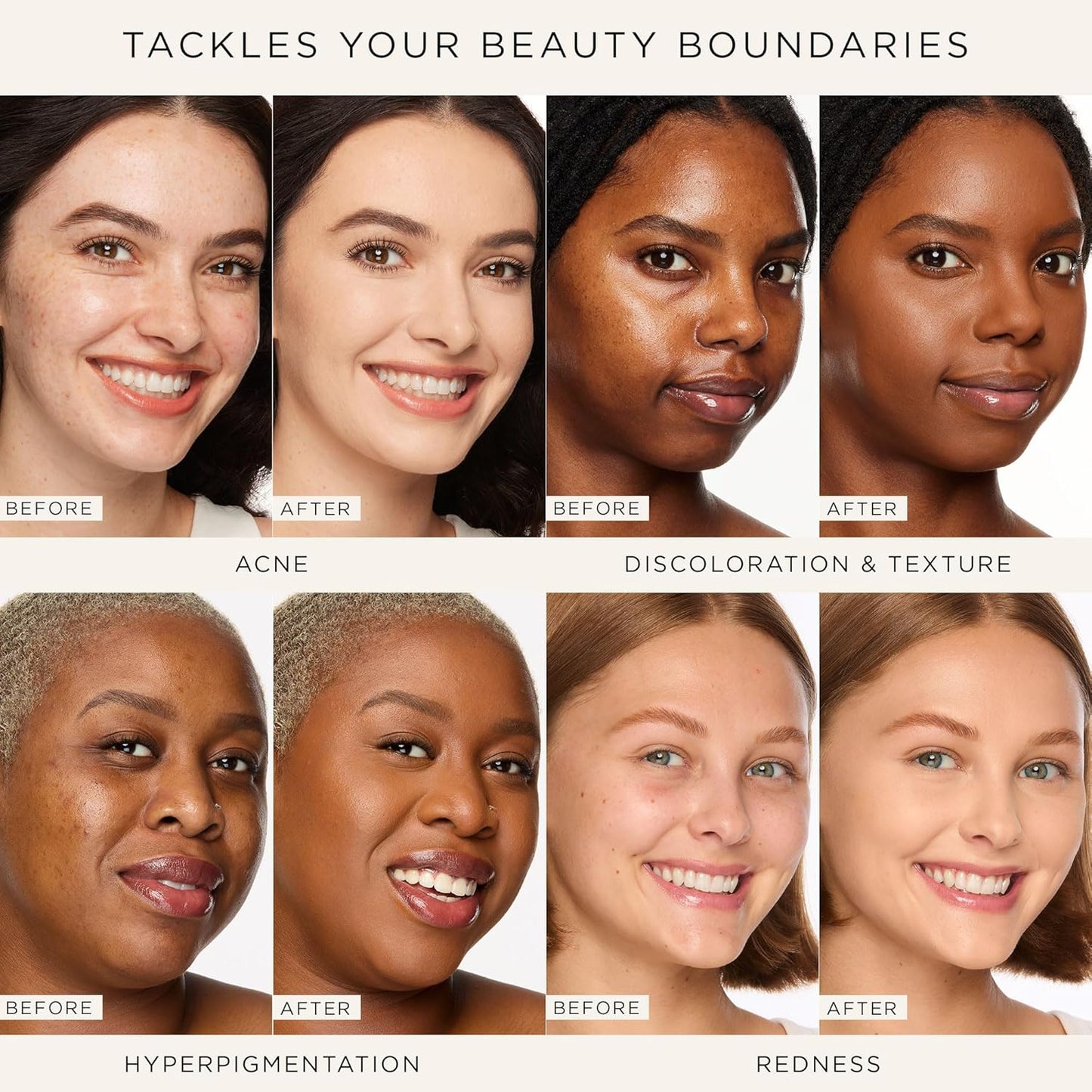 🔥Limited Time Discount-49% Off🔥Full-Coverage Concealer